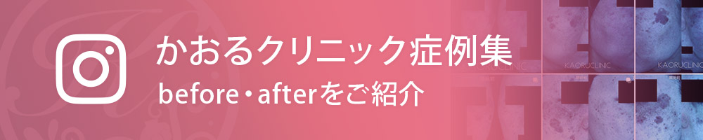かおるクリニックの症例集。before,after写真をInstagramで公開中