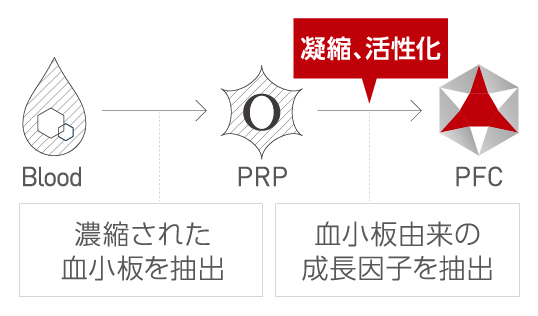 自身のPRPを高濃度に濃縮、活性化