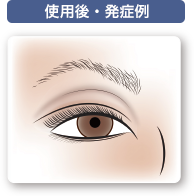 まつ毛の悩み 荻窪の皮膚科 かおるクリニック まつ毛の悩み 荻窪の皮膚科 かおるクリニック